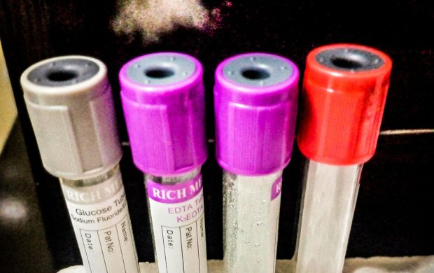 Tubos de muestras para análisis de laboratorio. Fotografía referencial.