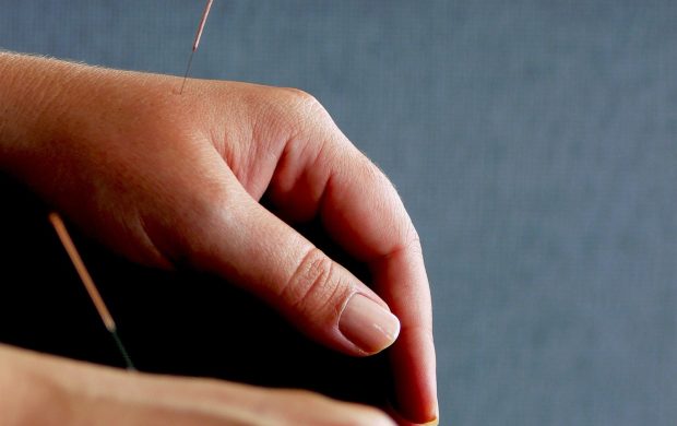 Aplicación de agujas de acupuntura. Fotografía referencial; no corresponde al hospital de la noticia.